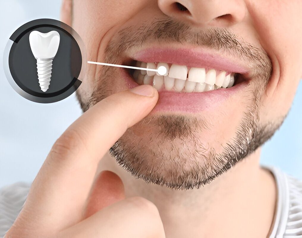 Dental Care in Fort Saskatchewan