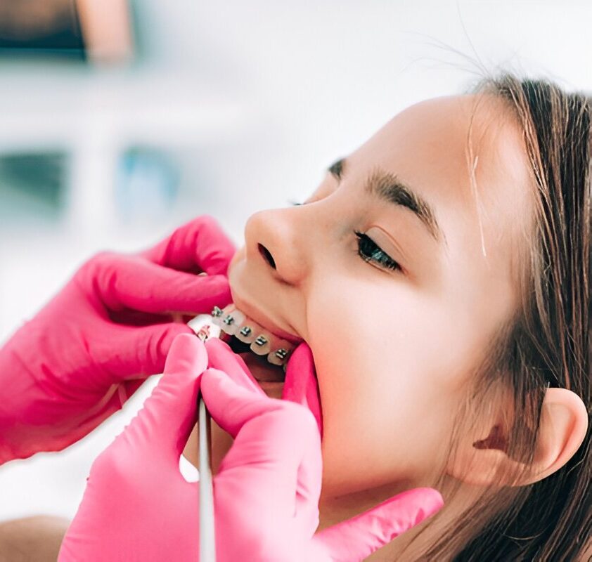 Early Orthodontic Evaluations for Children in Fort Saskatchewan